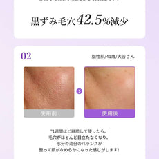 00:00 アネトス 3点セット（エッセンス＋PHA Pバランス セラム＋クレーパック）