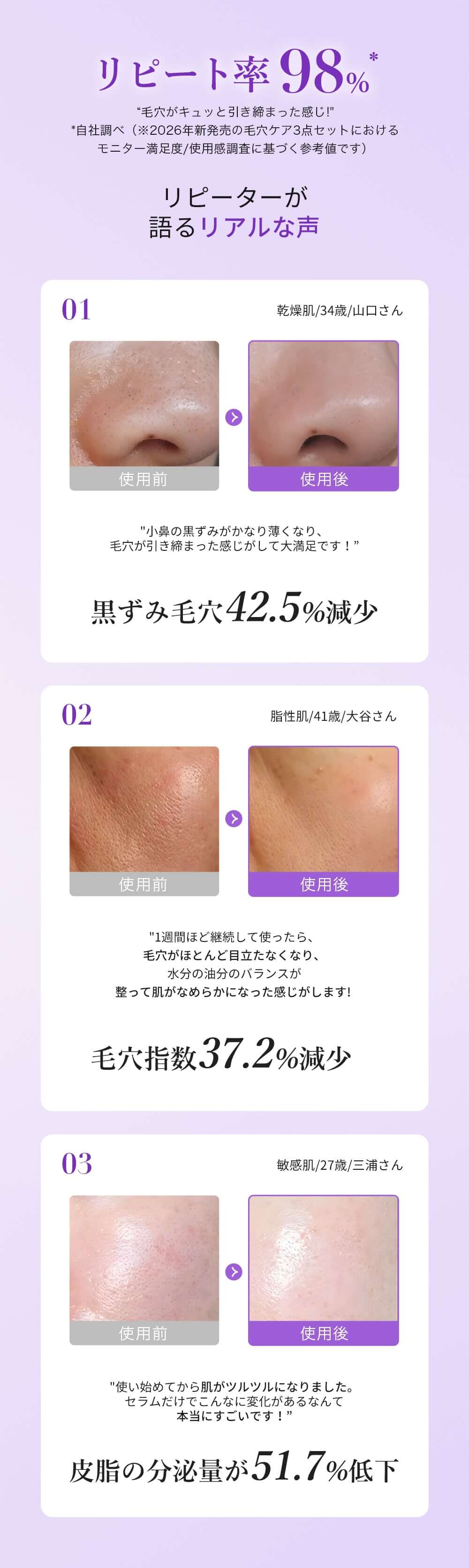 00:00 アネトス 3点セット（エッセンス＋PHA Pバランス セラム＋クレーパック）