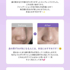 00:00 アネトス 3点セット（エッセンス＋PHA Pバランス セラム＋クレーパック）