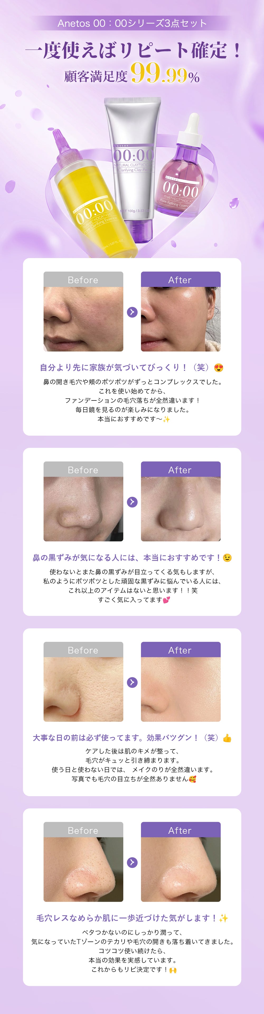 00:00 アネトス 3点セット（エッセンス＋PHA Pバランス セラム＋クレーパック）