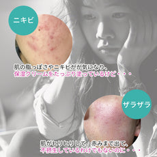 22:00 アネトス クリーム