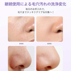 使用前後イメージ：00:00 アネトス クラリファイング クレー パックによる毛穴の変化を示した画像