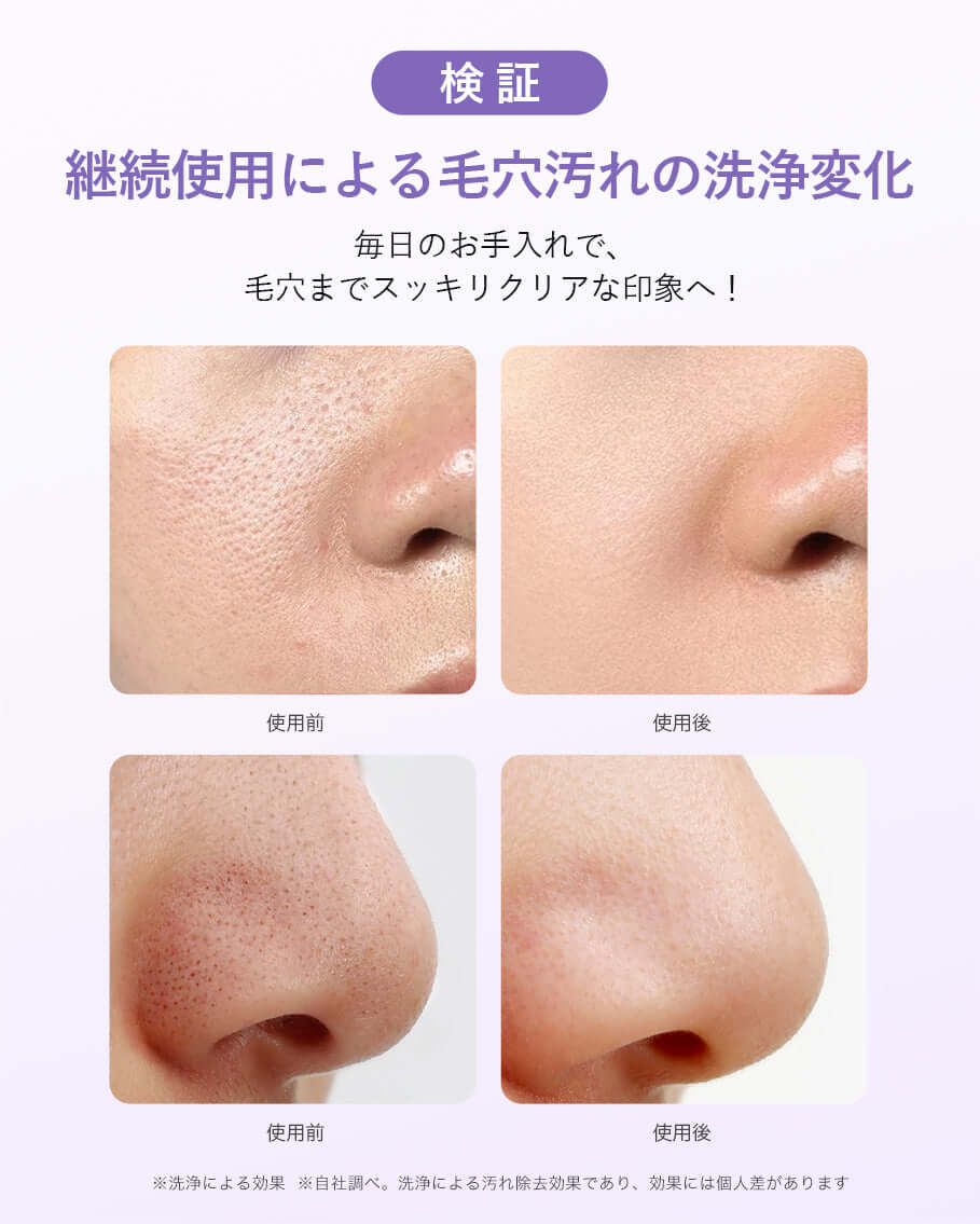 使用前後イメージ：00:00 アネトス クラリファイング クレー パックによる毛穴の変化を示した画像