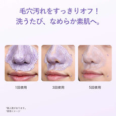 使用前後イメージ、毛穴ケアに効果的なクレーパックの使用結果。00:00 アネトス 3点セット（エッセンス＋クレーパック＋PHA Pバランス セラム）