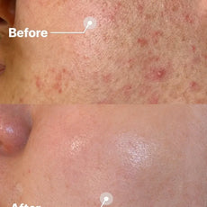 22:00  アネトス  セラム（初めての方限定｜15日間お試しサイズ｜お一人様1回・1点限り）