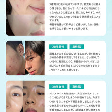 使用前後イメージ：20代と30代の男女がニキビに関するリアルなレビューの画像