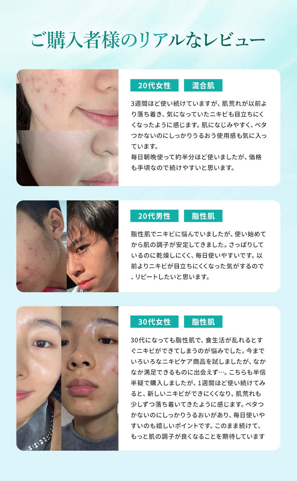 使用前後イメージ：20代と30代の男女がニキビに関するリアルなレビューの画像