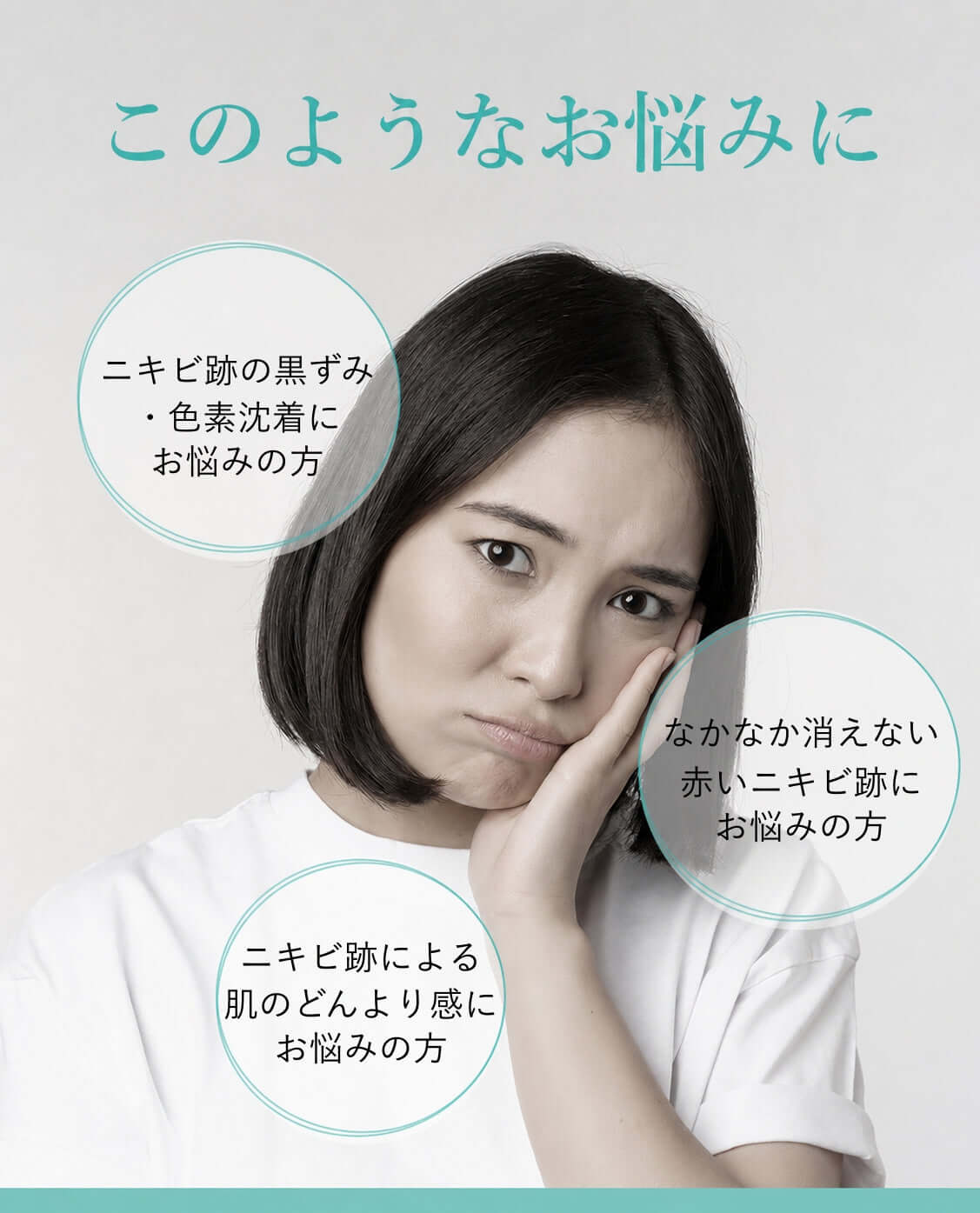 ニキビ跡や肌荒れに悩む女性の画像。22:00 アネトス セラム 2点セットの紹介。