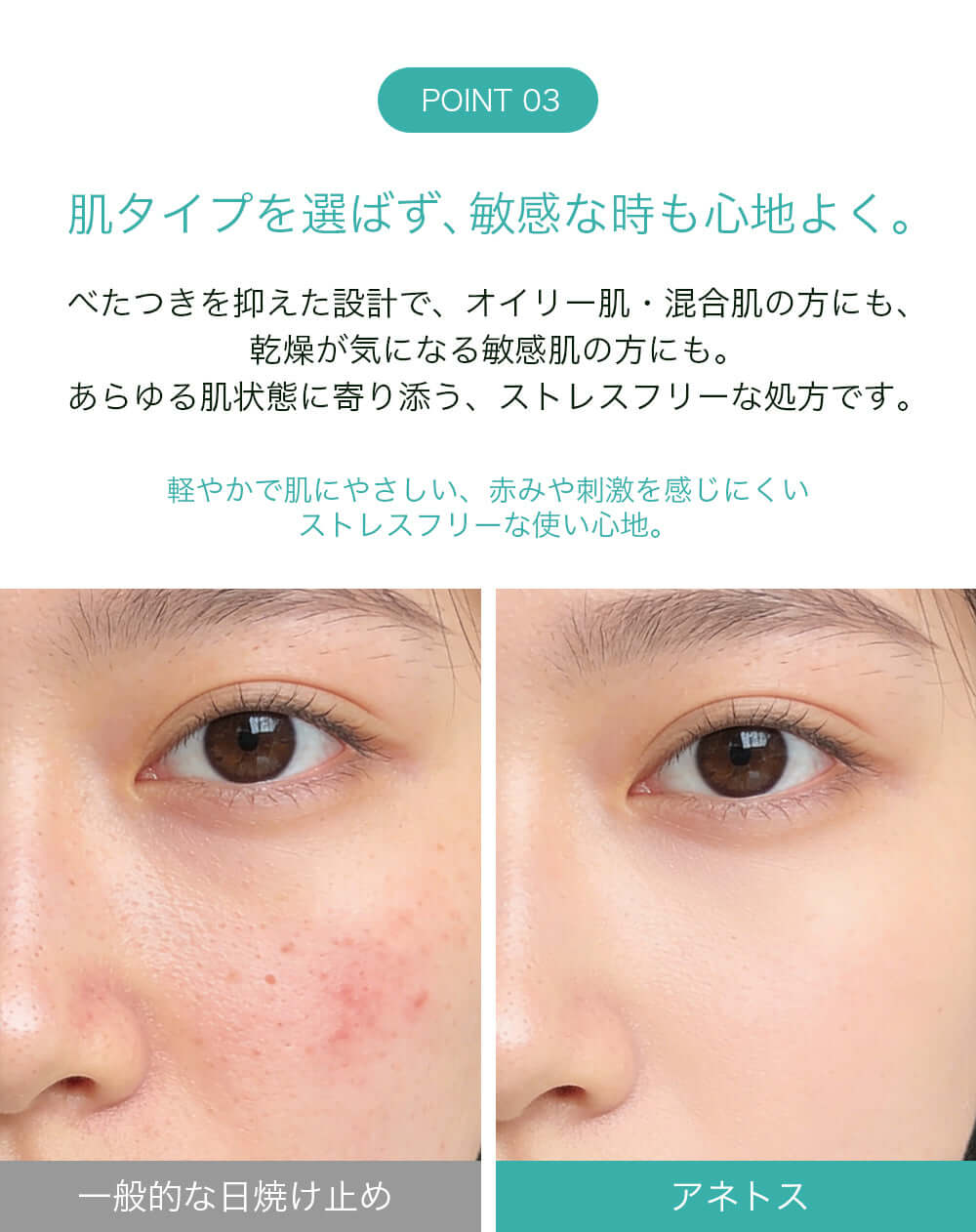 使用前後イメージ：22:00 アネトス2点セット（セラム＋UV エマルジョン）の効果を示す画像