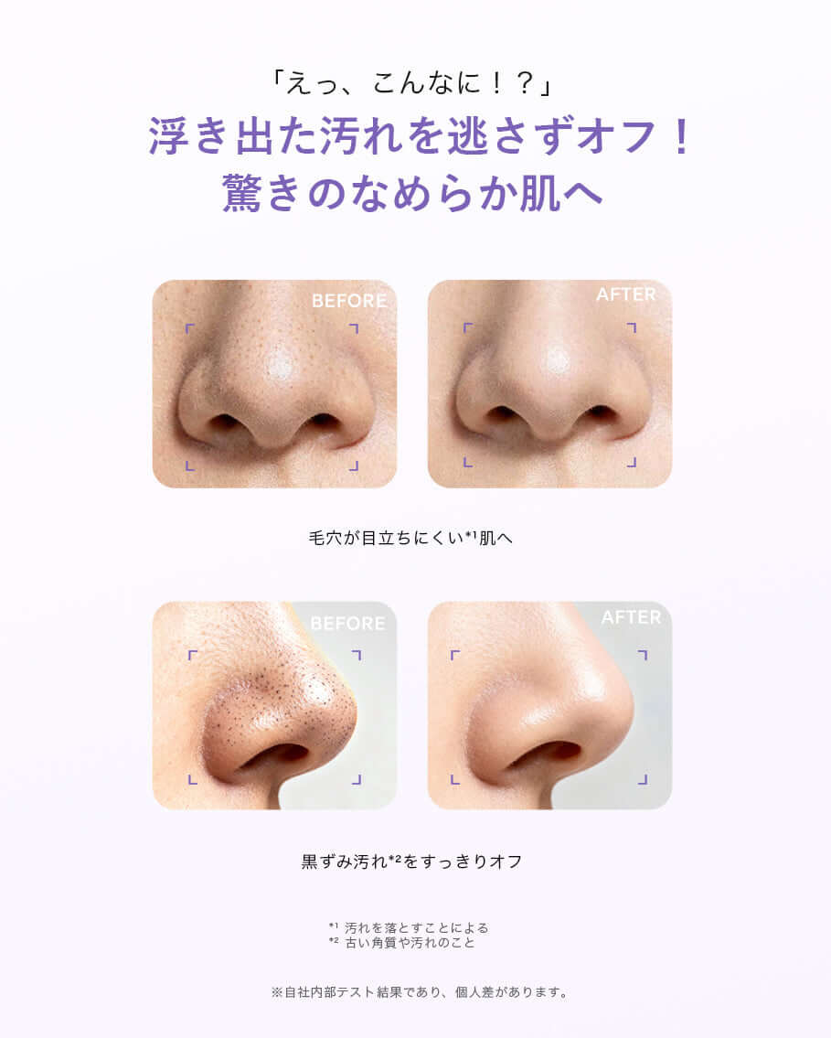 使用前後イメージ：00:00 クラリファイング エッセンスを使った肌の改善を示す画像。