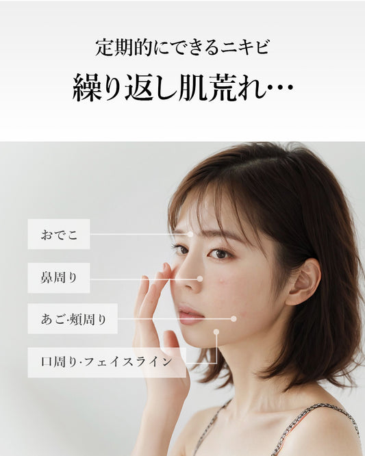 22:00 アネトス　アクネケア　トリートメント　セラム